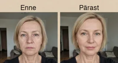Enne ja pärast 1