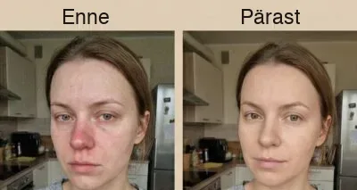Enne ja pärast 2