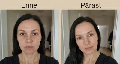Enne ja pärast 3