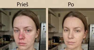 Enne ja pärast 2